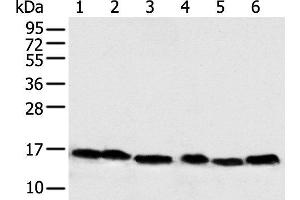 Western blot analysis of 293T Hela PC-3 Lncap and 231 cell Human fetal muscle tissue using NDUFB6 Polyclonal Antibody at dilution of 1:500 (NDUFB6 Antikörper)