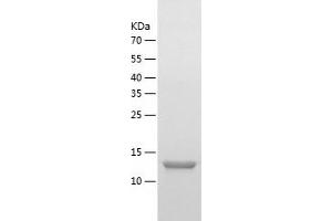Western Blotting (WB) image for Cold Shock Domain Containing C2, RNA Binding (CSDC2) (AA 1-153) protein (His tag) (ABIN7122439) (CSDC2 Protein (AA 1-153) (His tag))