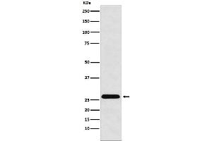 Western blot analysis of HLA-DRB4 expression in Raji cell lysate.