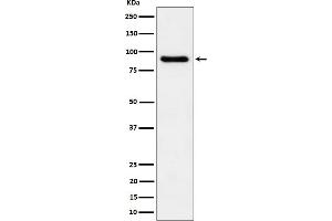 Western blot analysis of C1s expression in human plasma cell lysate.
