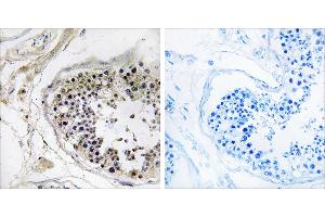 Peptide - +Immunohistochemistry analysis of paraffin-embedded human testis tissue using CST8 antibody.