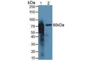 Western blot analysis of (1) Rat Kidney Tissue and (2) Rat Intestine Tissue. (Meprin B Antikörper  (AA 433-679))