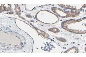 ABIN6267611 at 1/100 staining Human prostate tissue by IHC-P. (LIPE Antikörper  (pSer554, pSer855))