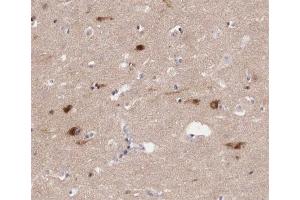 ABIN6267409 at 1/200 staining human brain tissue sections by IHC-P.