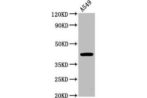 Western Blot Positive WB detected in: A549 whole cell lysate All lanes: CHST14 antibody at 4. (CHST14 Antikörper  (AA 70-133))