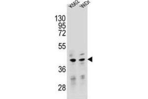 Western Blotting (WB) image for anti-Transcription Factor B2, Mitochondrial (TFB2M) antibody (ABIN2995537) (TFB2M Antikörper)