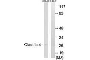 Western blot analysis of extracts from COLO cells, using Claudin 4 (Ab-208) Antibody. (Claudin 4 Antikörper  (AA 160-209))