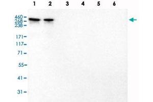 Western Blot analysis of recombinant protein Lane 1: Laminin-211, Lane 2: Laminin-221, Lane 3: Laminin-332, Lane 4: Laminin-421, Lane 5: Laminin-511 and Lane 6: Laminin-121 with LAMA2 monoclonal antibody, clone CL3450 . (Laminin Antikörper)