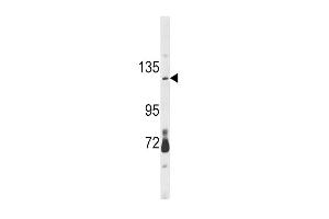 Western blot analysis of CLEC16A Antibody (Center) (ABIN390971 and ABIN2841151) in mouse brain tissue lysates (35 μg/lane). (CLEC16A Antikörper  (AA 365-391))