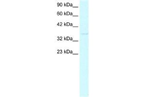 anti-Caudal Type Homeobox 4 (CDX4) (C-Term) antibody