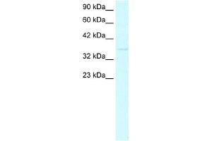 WB Suggested Anti-CDX4 Antibody Titration:  0. (CDX4 Antikörper  (C-Term))