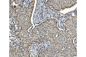 IHC analysis of MCM4 using anti-MCM4 antibody (ABIN7601485). (MCM4 Antikörper  (AA 361-677))