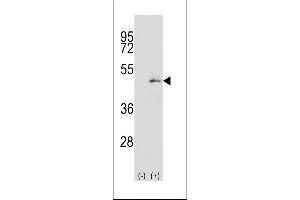 Western blot analysis of P2K1 (arrow) using rabbit polyclonal P2K1 Antibody  (ABIN392479 and ABIN2842059). (MEK1 Antikörper  (AA 196-225))