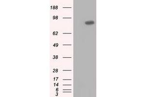 HEK293T cells were transfected with the pCMV6-ENTRY control (Left lane) or pCMV6-ENTRY USP5 (Right lane) cDNA for 48 hrs and lysed. (USP5 Antikörper)