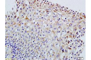 Formalin-fixed and paraffin embedded rat ovary labeled with Anti-FSH/FSHB Polyclonal Antibody, Unconjugated  at 1:200 followed by conjugation to the secondary antibody and DAB staining (FSHB Antikörper  (AA 61-98))