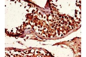 Immunohistochemistry of paraffin-embedded human testis tissue using ABIN7151222 at dilution of 1:100 (SMURF1 Antikörper  (AA 198-374))