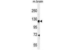 CENTG1 Antibody (C-term) western blot analysis in mouse brain tissue lysates (35µg/lane). (AGAP2 Antikörper  (C-Term))