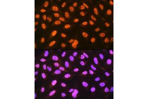 Immunofluorescence analysis of U-2 OS cells using hnRNP C Rabbit mAb (ABIN7267629) at dilution of 1:100 (40x lens). (HNRNPC Antikörper)