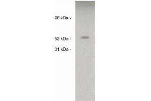 Image no. 1 for anti-Sulfatase 2 (SULF2) antibody (ABIN265173) (SULF2 Antikörper)