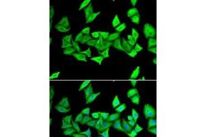 Immunofluorescence analysis of U2OS cells using H6PD Polyclonal Antibody (Glucose-6-Phosphate Dehydrogenase Antikörper)