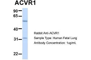 Host:  Rabbit  Target Name:  ACVR1  Sample Type:  Human Fetal Lung  Antibody Dilution:  1. (ACVR1 Antikörper  (N-Term))