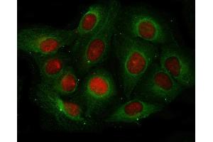 IF analysis of Angiogenin/ANG using anti-Angiogenin/ANG antibody (ABIN4886457) and anti-Beta Tubulin antibody (ABIN7602743). (ANG Antikörper  (AA 25-147))