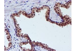 Image no. 1 for anti-Spermine Synthase, SMS (SMS) antibody (ABIN1501093) (SMS Antikörper)