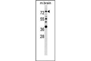 Western blot analysis of Estrogen receptor alpha  Antibody  in mouse brain tissue lysates (35ug/lane). (Estrogen Receptor alpha Antikörper  (AA 53-301))