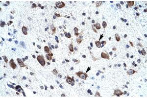 Rabbit Anti-MORF4L2 Antibody ,Paraffin Embedded Tissue: Human neural cell  Cellular Data: Epithelial cells of renal tubule  Antibody Concentration: 4. (MORF4L2 Antikörper  (N-Term))