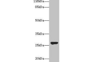 Western blot All lanes: IZUMO4 antibody at 2 μg/mL + Rat gonadal tissue Secondary Goat polyclonal to rabbit IgG at 1/10000 dilution Predicted band size: 27, 25, 18, 19 kDa Observed band size: 27 kDa (IZUMO4 Antikörper  (AA 16-214))