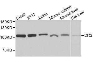 Western blot analysis of extracts of various cell lines, using CR2 antibody. (CD21 Antikörper  (AA 300-590))