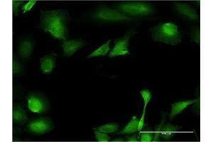 Immunofluorescence of monoclonal antibody to B3GNT3 on HeLa cell.