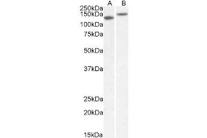 Image no. 2 for anti-Contactin 1 (CNTN1) (AA 585-870) antibody (ABIN5863341) (Contactin 1 Antikörper  (AA 585-870))