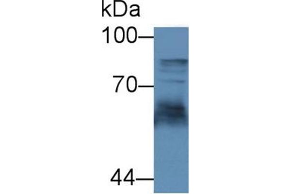 Transferrin Receptor 2 anticorps  (AA 211-405)