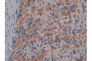 Detection of FABP9 in Rat Stomach Tissue using Polyclonal Antibody to Fatty Acid Binding Protein 9, Testis (FABP9) (FABP9 Antikörper  (AA 1-130))