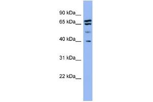 WB Suggested Anti-SH3GL2  Antibody Titration: 0.