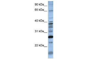 WB Suggested Anti-DOLPP1 Antibody Titration:  0. (DOLPP1 Antikörper  (N-Term))