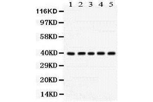 Western Blotting (WB) image for anti-Cyclin-Dependent Kinase 7 (CDK7) (AA 31-346) antibody (ABIN3042742) (CDK7 Antikörper  (AA 31-346))