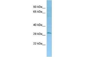 WB Suggested Anti-DERL2 Antibody Titration: 1.