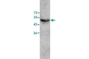 Western blot analysis of human fetal colon lysate with ZC3H10 polyclonal antibody  at 1 : 500 dilution. (ZC3H10 Antikörper  (AA 136-412))