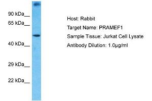 Host: Rabbit Target Name: PRAMEF1 Sample Type: Jurkat Whole Cell lysates Antibody Dilution: 1. (PRAMEF1 Antikörper  (N-Term))