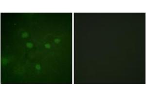 Immunofluorescence analysis of COS7 cells, using NFAT5 (Phospho-Ser1197) Antibody. (NFAT5 Antikörper  (pSer1197))