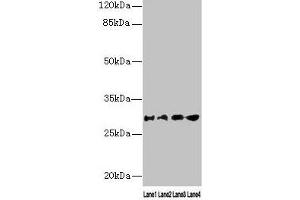 Western blot All lanes: AQP1 antibody at 16 μg/mL Lane 1: Rat heart tissue Lane 2: Mouse skeletal muscle tissue Lane 3: A549 whole cell lysate Lane 4: 293T whole cell lysate Secondary Goat polyclonal to rabbit IgG at 1/10000 dilution Predicted band size: 29, 20, 24, 17 kDa Observed band size: 29 kDa (Aquaporin 1 Antikörper  (AA 220-269))