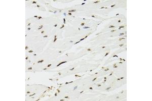 Immunohistochemistry of paraffin-embedded mouse heart using EDF1 antibody (ABIN5971272) at dilution of 1/100 (40x lens). (EDF1 Antikörper)