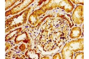 Immunohistochemistry (IHC) image for anti-Integrin alpha V (ITGAV) (AA 775-885) antibody (ABIN7156468)