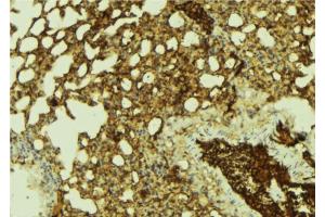ABIN6269406 at 1/100 staining Mouse lung tissue by IHC-P. (HDAC5 Antikörper  (Internal Region))