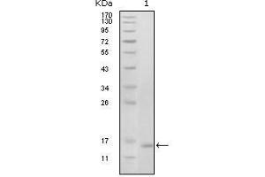 Western Blot showing EhpB6 antibody used against truncated EhpB6 recombinant protein (1). (EPH Receptor B6 Antikörper  (AA 601-750))