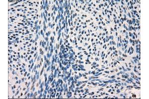 Immunohistochemical staining of paraffin-embedded endometrium tissue using anti-FRKmouse monoclonal antibody. (FRK Antikörper)