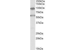 ABIN2560309 (0. (TBC1D9 Antikörper  (Internal Region))