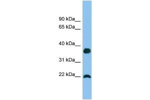 WB Suggested Anti-WFDC1 Antibody Titration: 0.